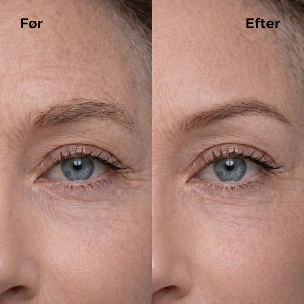 Veloura Nordic  Elektrisk ansiktshårfjerner