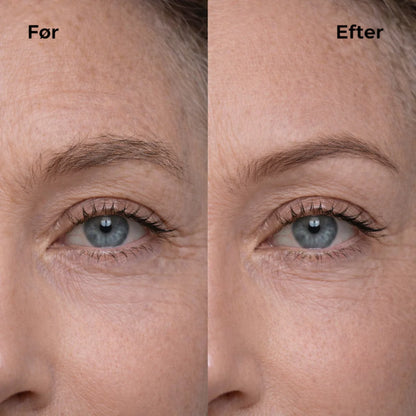 Veloura Nordic  Elektrisk ansiktshårfjerner